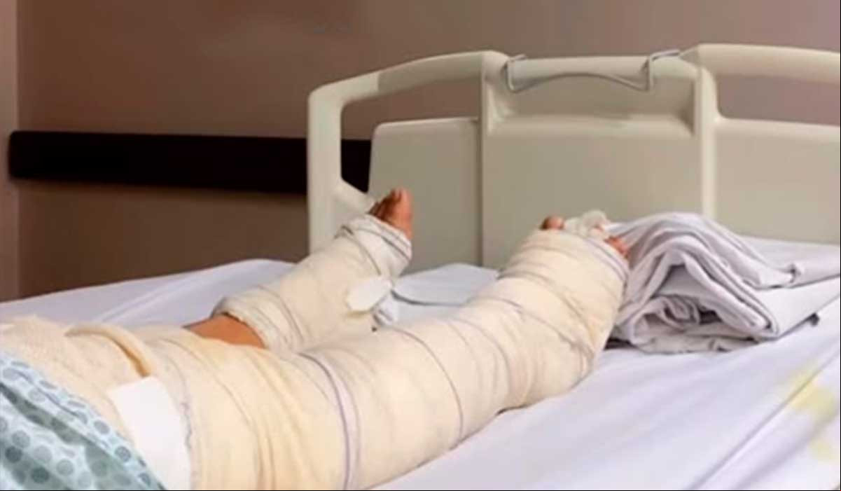 Amanda ou por cirurgia e permanece em recuperação.